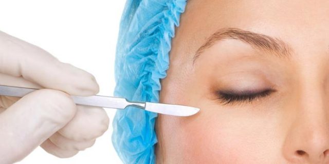 elevar las cejas y ganar volumen mediante una blefaroplastia operacion de parpados