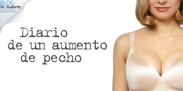Diario de un aumento de pecho