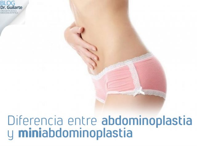 Diferencia entre abdominoplastia y MINIabdominoplastia diferencia entre abdominoplastia y miniabdominoplastia