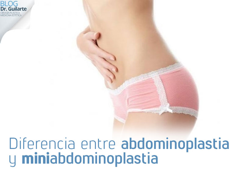 Diferencia entre abdominoplastia y MINIabdominoplastia diferencia entre abdominoplastia y miniabdominoplastia