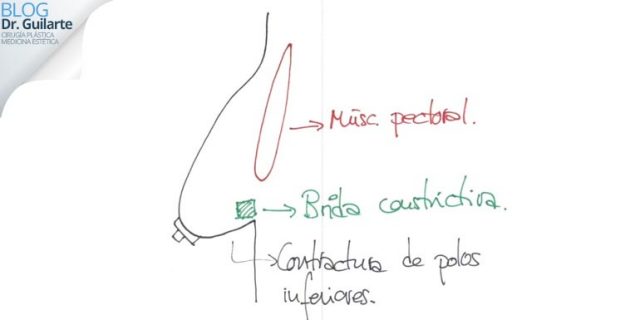 esbozo-drguilarte-los-mejores-cirujanos-plasticos-de-espana esbozo drguilarte los mejores cirujanos plasticos de España