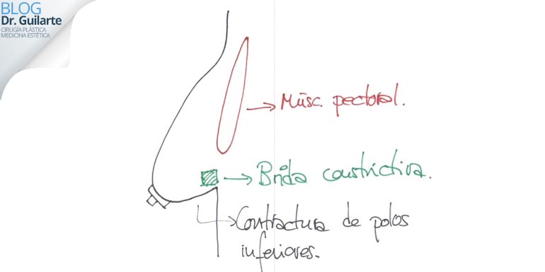 esbozo-drguilarte-los-mejores-cirujanos-plasticos-de-espana esbozo drguilarte los mejores cirujanos plasticos de España