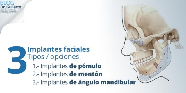 implantes faciales madrid espana tipos y opciones pomulo menton angulo mandibular