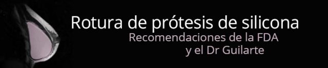 El mejor cirujano plastico de madrid recomendacion rotura protesis silicona