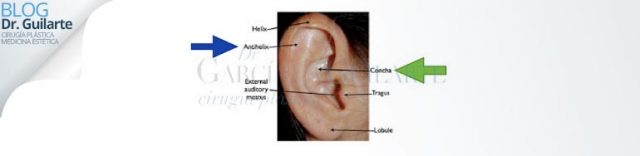 otoplastia operacion orejas mejor cirujano plastico madrid