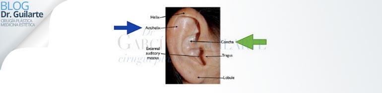 otoplastia-operacion-orejas-mejor-cirujano-plastico-madrid otoplastia operacion orejas mejor cirujano plastico madrid