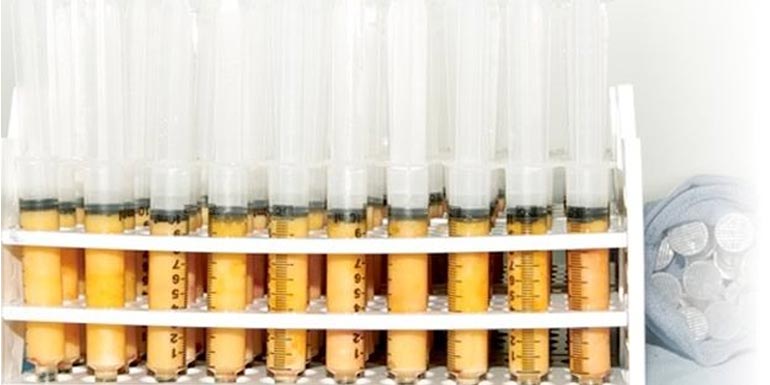 Episiotomía, cicatrices dolorosas ¿Lipofilling como solución? Episiotomía, cicatrices dolorosas ¿Lipofilling como solución?