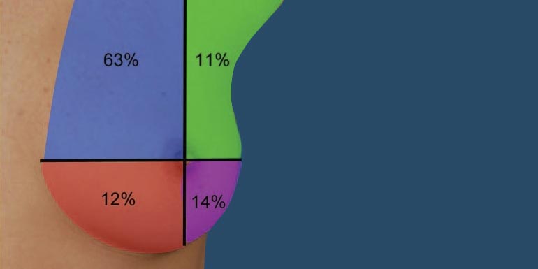 pecho dividido en subunidades esteticas, recursos para cirujanos plasticos pecho dividido en subunidades esteticas recursos para cirujanos plasticos