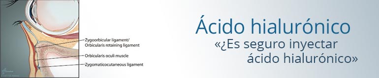 acido hialuronico es seguro inyectar hialuronico en las ojeras