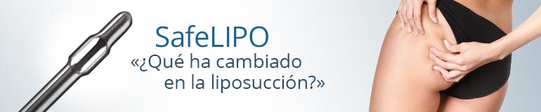 safelipo que ha cambiado en la liposuccion
