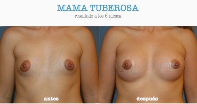 MAMA-TUBEROSA.001-001