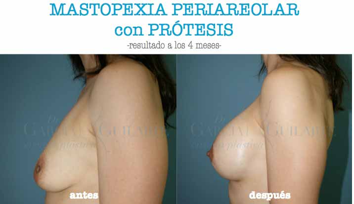 mejor_cirujano_plastico_madrid