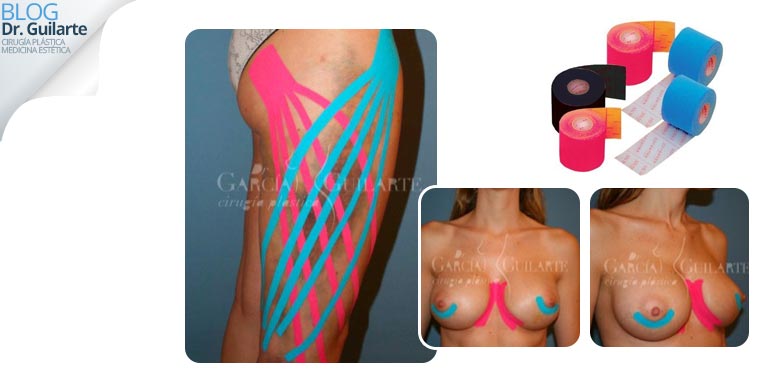 kinesioterapia en cirugia estetica para mejorar los resultados kinesioterapia en cirugia estetica para mejorar los resultados