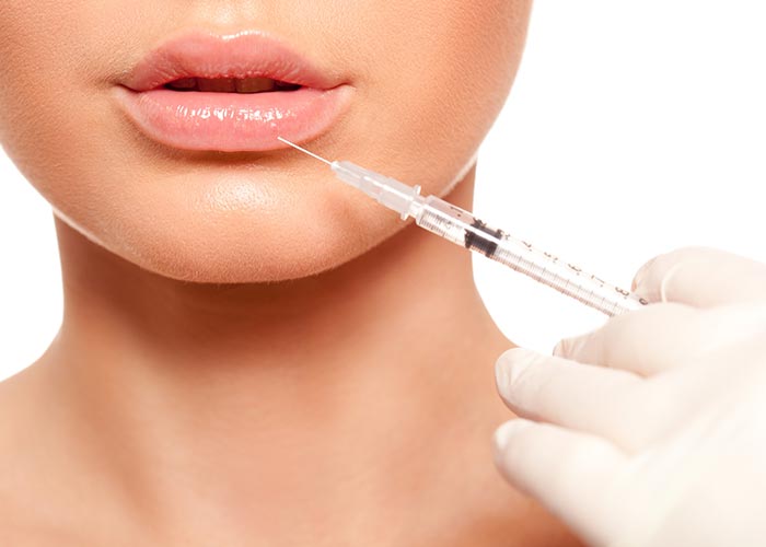 acido hialuronico labios madrid