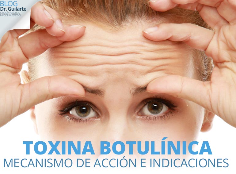 Botox o toxina botulínca: mecanismos de acción e indicaciones Botox o toxina botulínca: mecanismos de acción e indicaciones