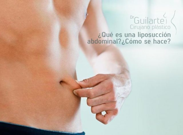 ¿Qué es una liposucción abdominal y cómo se hace?