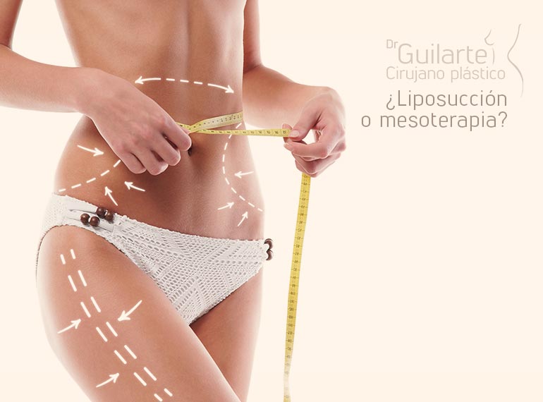 ¿Liposucción o mesoterapia? ¿Liposucción o mesoterapia?