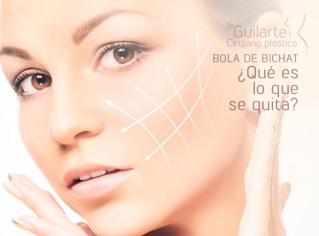 Bola de Bichat ¿Qué es lo que se quita? Explicado por el cirujano plástico Dr Guilarte