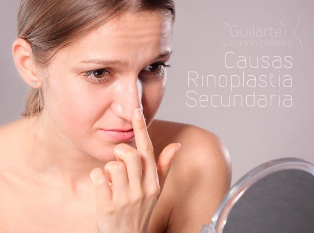 Causas Rinoplastia Secundaria