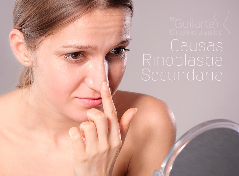 Causas Rinoplastia Secundaria Causas Rinoplastia Secundaria