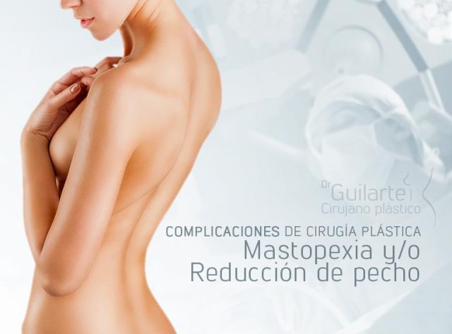 Complicaciones de cirugía plástica: mastopexia y/o reducción de pecho. Posibles complicaciones con la elevación de pecho y/o mamoplastia de reducción mamaria