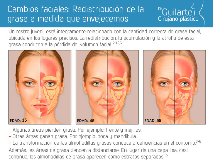 Cambios faciales según la redistribución de la grasa cuando envejecemos