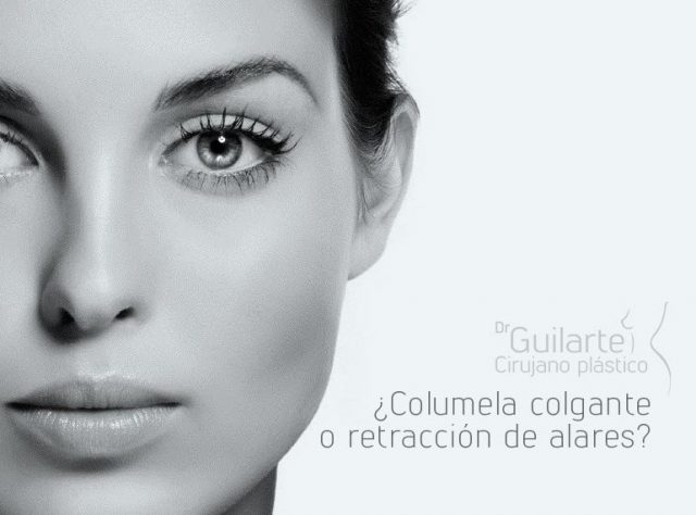 ¿Columela colgante o retracción de alares?
