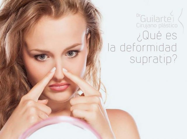 ¿Qué es la deformidad Supratip?