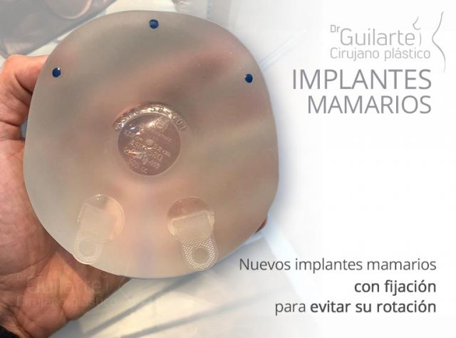 Nuevos implantes mamarios con fijación para evitar su rotación Nuevos implantes mamarios con fijación para evitar su rotación