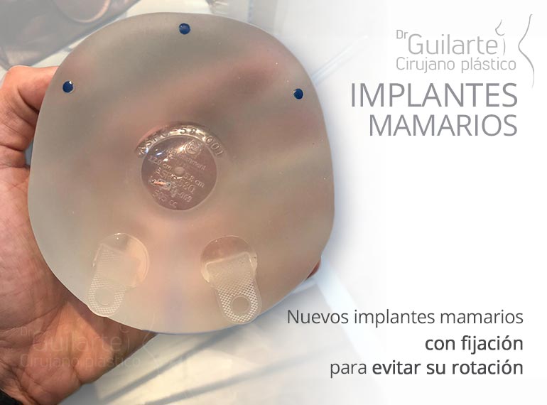 Nuevos implantes mamarios con fijación para evitar su rotación Nuevos implantes mamarios con fijación para evitar su rotación