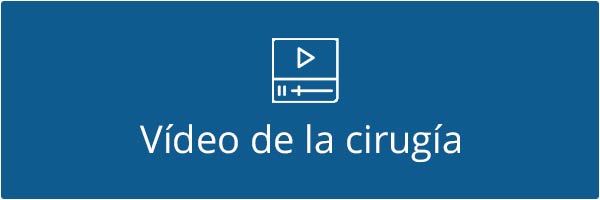 Botón vídeo de la cirugía Botón vídeo de la cirugía