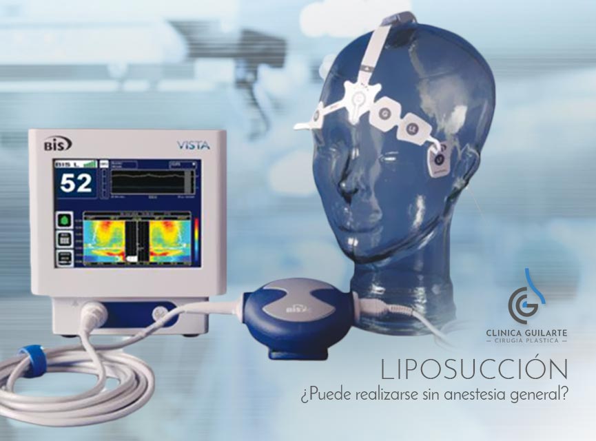 Tipos de anestesia en liposucción ¿anestesia local o general? Tipos de anestesia en liposucción ¿anestesia local o general?
