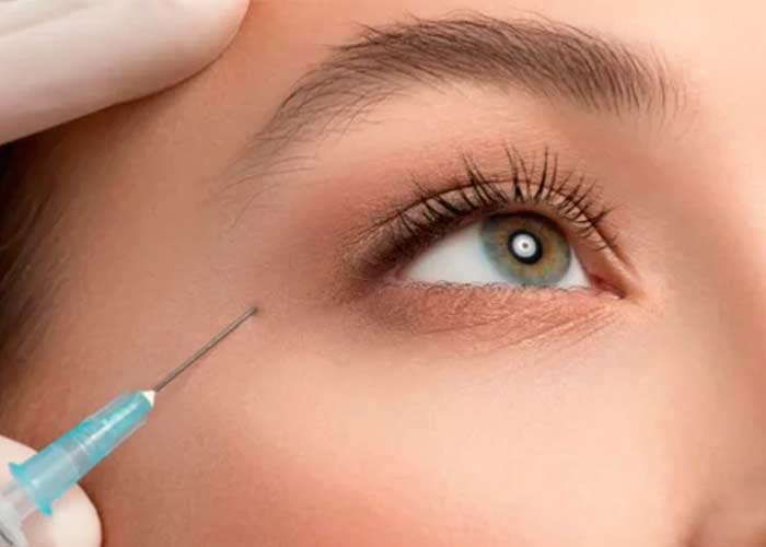 Ácido hialurónico en Madrid: uso en contorno de ojos para rejuvenecer la mirada