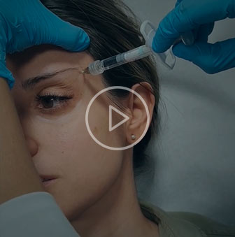 Acido hialurónico para rejuvenecer la mirada
