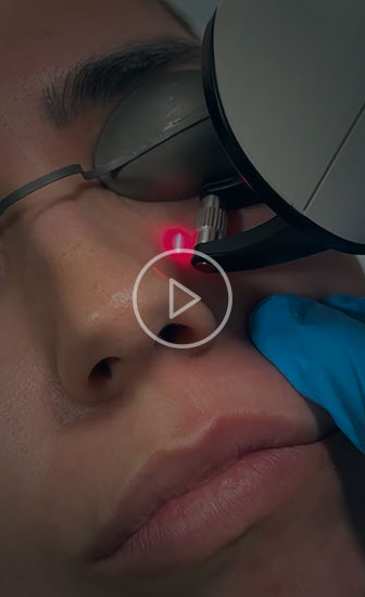 Efecto "Guilarte Skyn & Glow", uso de láser y neuromoduladores