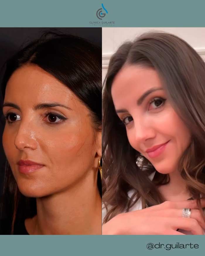 El verdadero 'antes y después'