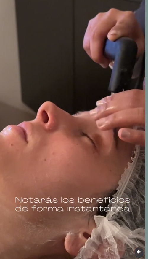 INDIBA Facial - Notarás los beneficios de forma instantánea INDIBA Facial - Notarás los beneficios de forma instantánea