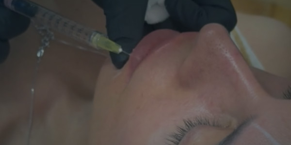 Neuromoduladores para tratar lineas de expresión, ácido hialurónico para potenciar tu belleza Neuromoduladores para tratar lineas de expresión, ácido hialurónico para potenciar tu belleza