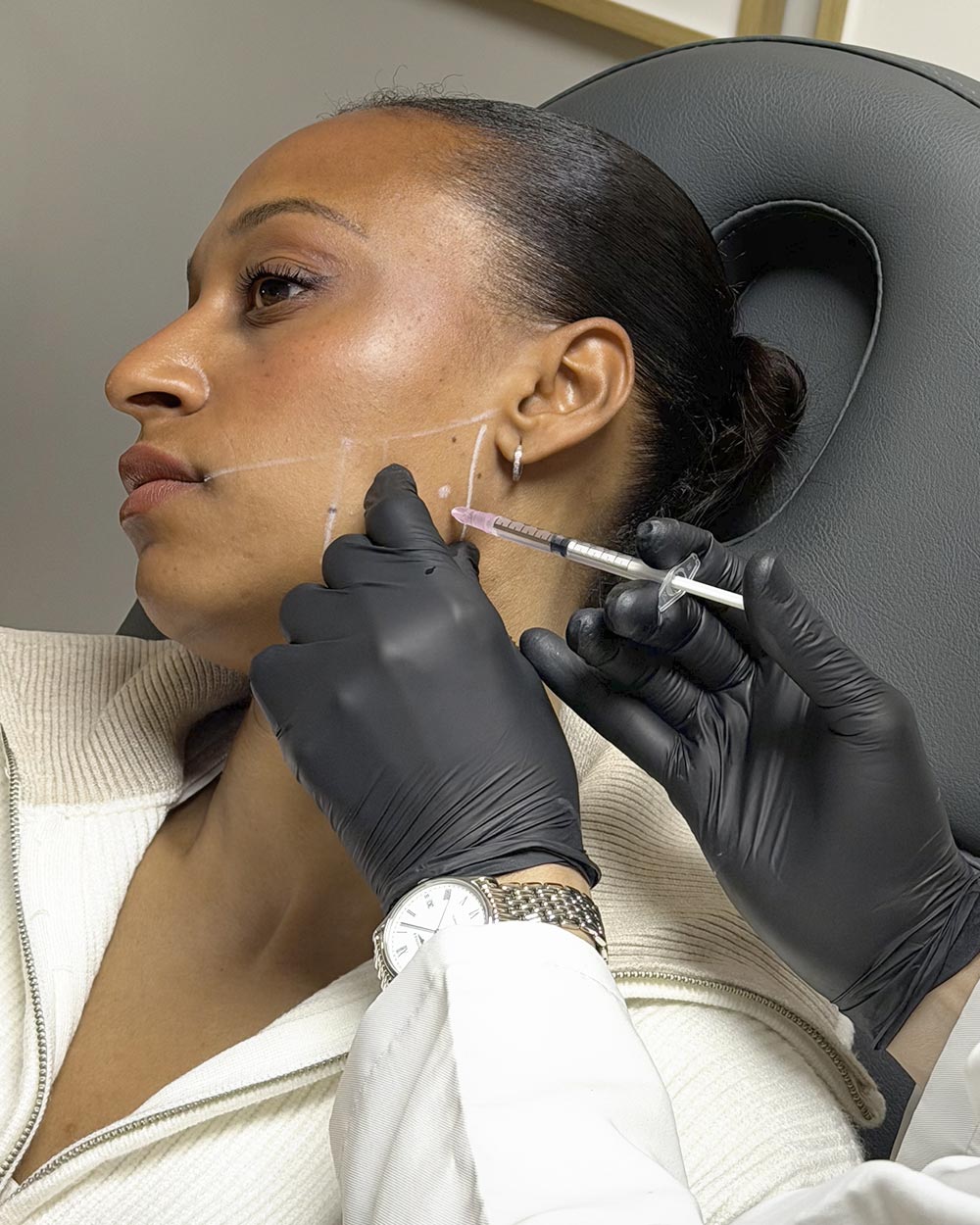 Tratamientos de medicina estética realizados en la Clínica Guilarte