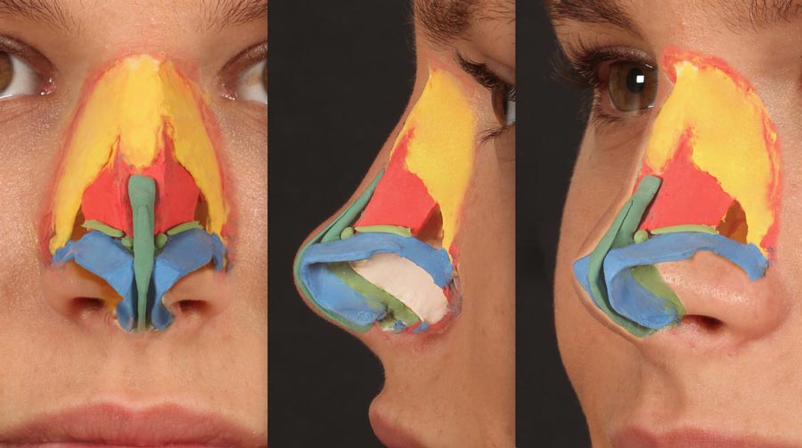 Anatomía nasal según el Dr. Baris Çakir